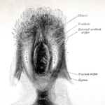Vulva image showing vestibule, hymen, clitoris, introitus, labia majora, labia minora, mons pubis, external urethral orifice, vaginal entrance and anus